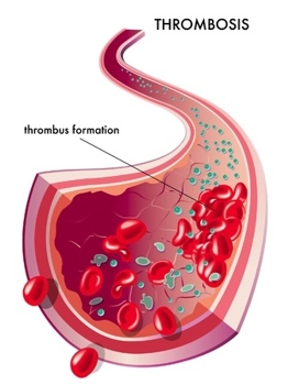 Thrombose und Mikronährstoffe